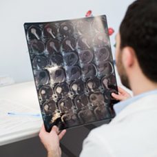 img-brain-tumors